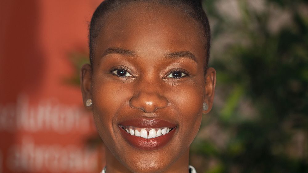 benedicte akambu - diastema - 3Dental